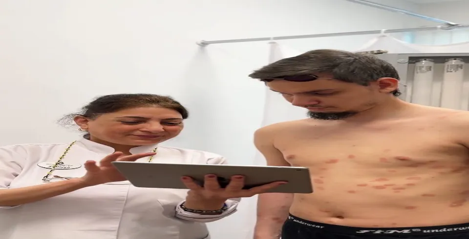 Лечение псориаза в Нафталане — эффективная нафталановая терапия в лучшем санатории Азербайджана